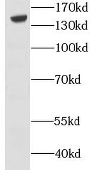 ADGRL3 Rabbit Polyclonal Antibody