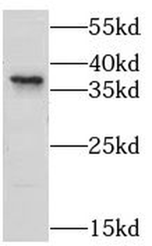 PLPPR2 Rabbit Polyclonal Antibody
