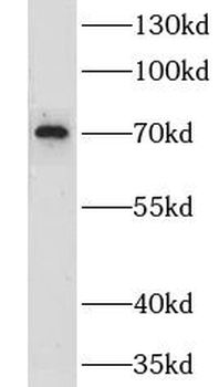LRCH3 Rabbit Polyclonal Antibody