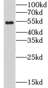 PIDD1 Rabbit Polyclonal Antibody