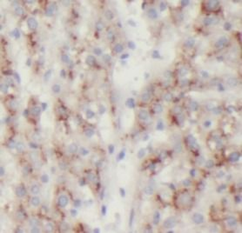LRG1 Rabbit Polyclonal Antibody
