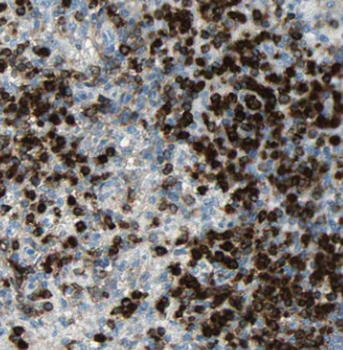 IRAG2 Rabbit Polyclonal Antibody