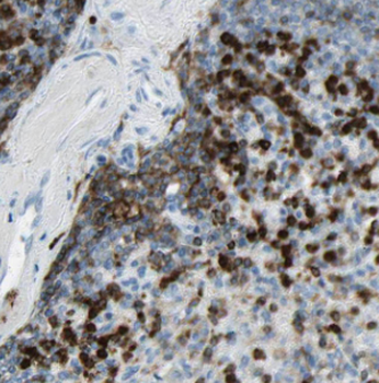 IRAG2 Rabbit Polyclonal Antibody