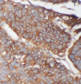 LRP5 Rabbit Polyclonal Antibody