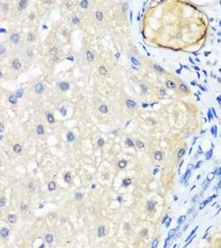 LRP5 Rabbit Polyclonal Antibody