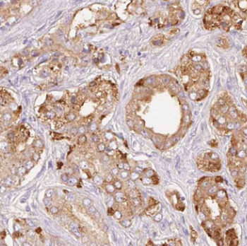 LRRC1 Rabbit Polyclonal Antibody