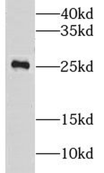 LRRC20 Rabbit Polyclonal Antibody