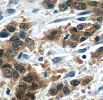 LRRC20 Rabbit Polyclonal Antibody