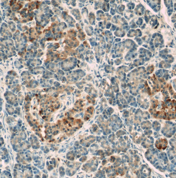LRRC47 Rabbit Polyclonal Antibody