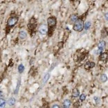 LRRC4C Rabbit Polyclonal Antibody