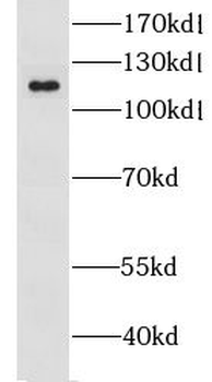 LRRC8D Rabbit Polyclonal Antibody