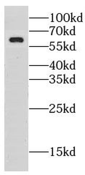 LRRTM1 Rabbit Polyclonal Antibody