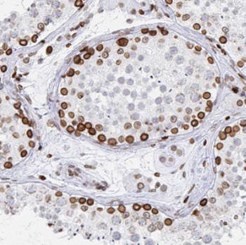 LRRTM1 Rabbit Polyclonal Antibody