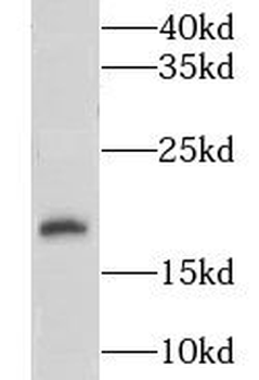 LSM1 Rabbit Polyclonal Antibody