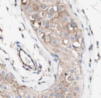 LSM14A Rabbit Polyclonal Antibody