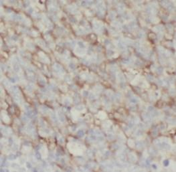 LY6D Rabbit Polyclonal Antibody