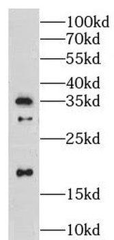 LY96 Rabbit Polyclonal Antibody
