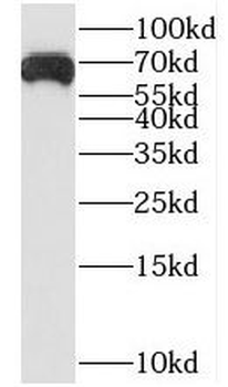 LZTS1 Rabbit Polyclonal Antibody