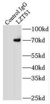 LZTS1 Rabbit Polyclonal Antibody