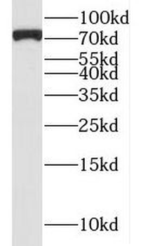 LZTS2 Rabbit Polyclonal Antibody