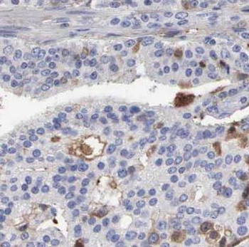 LZTS2 Rabbit Polyclonal Antibody