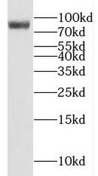 MAD1L1 Rabbit Polyclonal Antibody