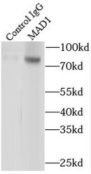 MAD1L1 Rabbit Polyclonal Antibody