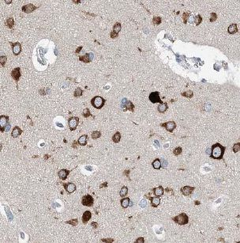 MAD1L1 Rabbit Polyclonal Antibody