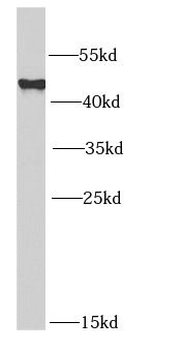 MAGEA1 Rabbit Polyclonal Antibody