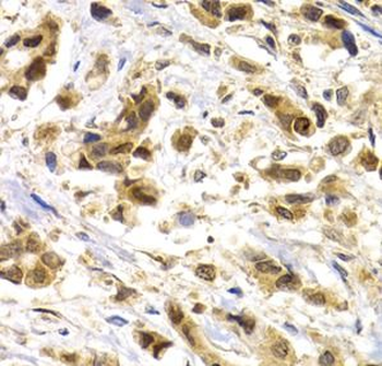 MAGEA1 Rabbit Polyclonal Antibody