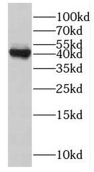MAGEA1 Rabbit Polyclonal Antibody