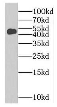 MAGEA11 Rabbit Polyclonal Antibody
