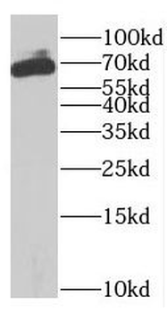 MAGEA6 Rabbit Polyclonal Antibody