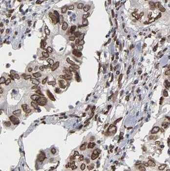 MAGEA6 Rabbit Polyclonal Antibody