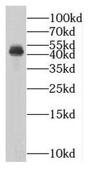 MAGEB1 Rabbit Polyclonal Antibody