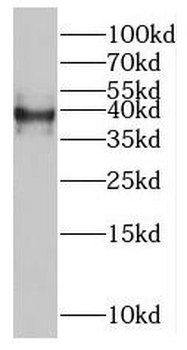 MAGEB4 Rabbit Polyclonal Antibody