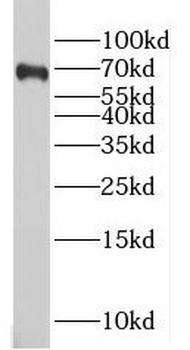 MAGED2 Rabbit Polyclonal Antibody