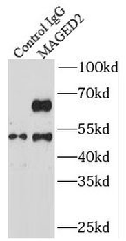 MAGED2 Rabbit Polyclonal Antibody