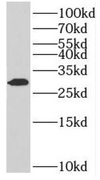 MAGIX Rabbit Polyclonal Antibody