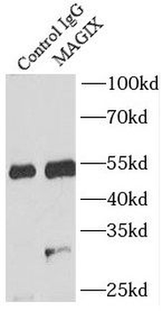 MAGIX Rabbit Polyclonal Antibody