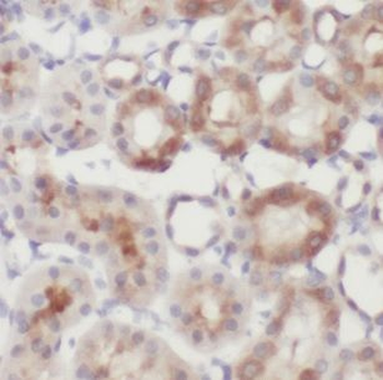 MAGIX Rabbit Polyclonal Antibody
