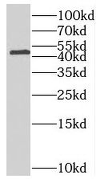 MAGT1 Rabbit Polyclonal Antibody