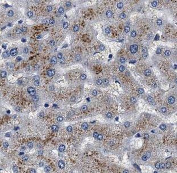 MAGT1 Rabbit Polyclonal Antibody