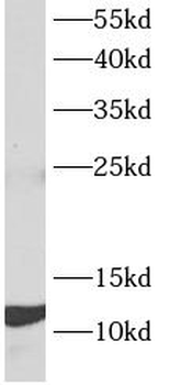 MANBAL Rabbit Polyclonal Antibody