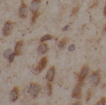 MANBAL Rabbit Polyclonal Antibody