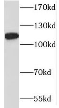 MAP1S Rabbit Polyclonal Antibody