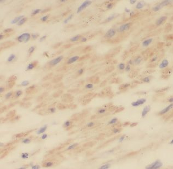 MAP1S Rabbit Polyclonal Antibody