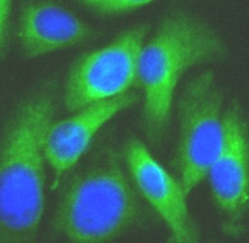 MAP2K6 Rabbit Polyclonal Antibody
