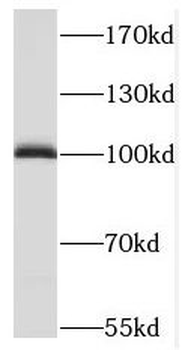 MAP7 Rabbit Polyclonal Antibody
