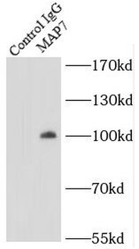 MAP7 Rabbit Polyclonal Antibody